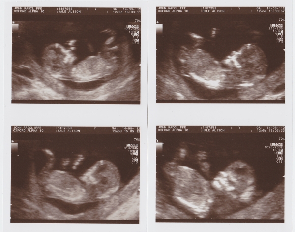Baby-Luke