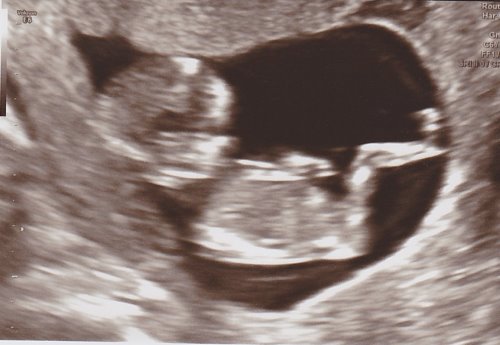 Another Baby On the Way (And What This Means for Aliventures)